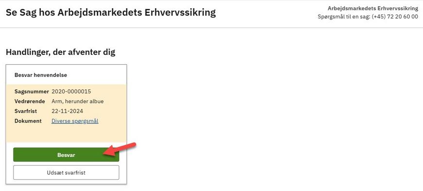 Se Sag - Besvar henvendelse